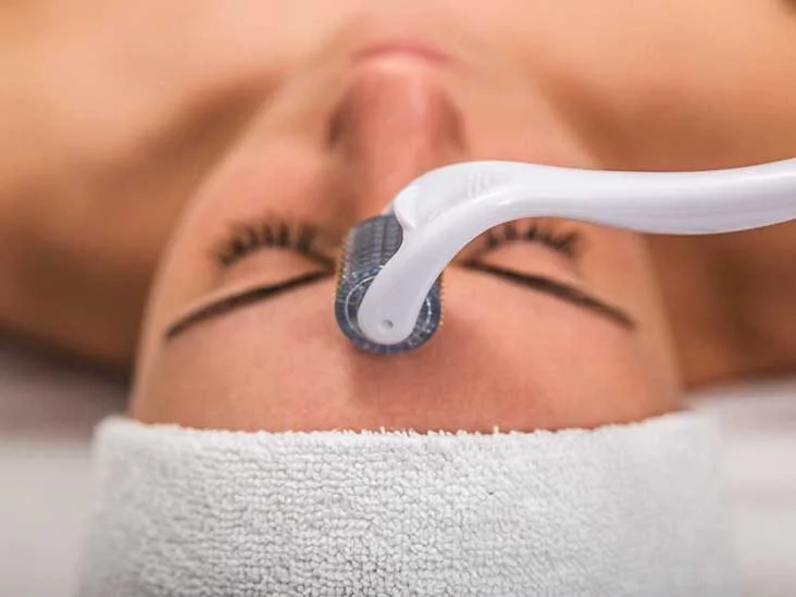The Beauty of Microneedling in Dubai: A Traveler's Guide
