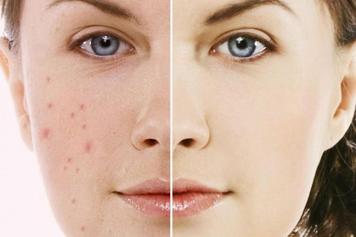 "Discover the Fountain of Youth: Revitalize Your Skin with Pigmentation Treatment in Dubai"