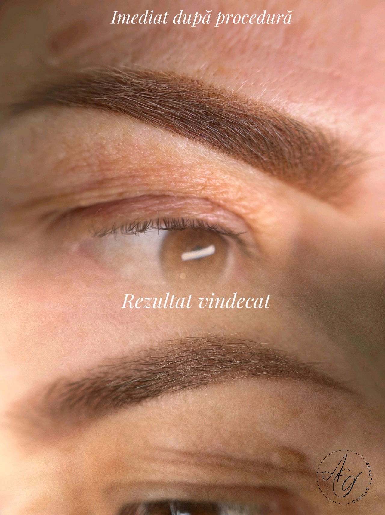 Rezultat vindecat pe ten matur