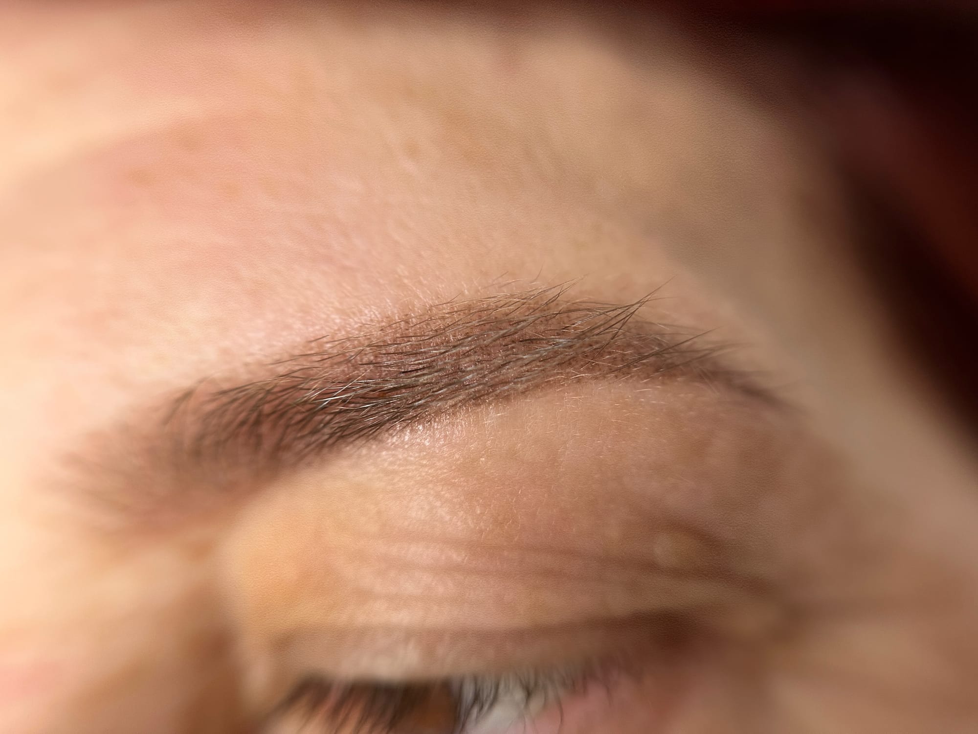 Rezultat vindecat pe ten matur