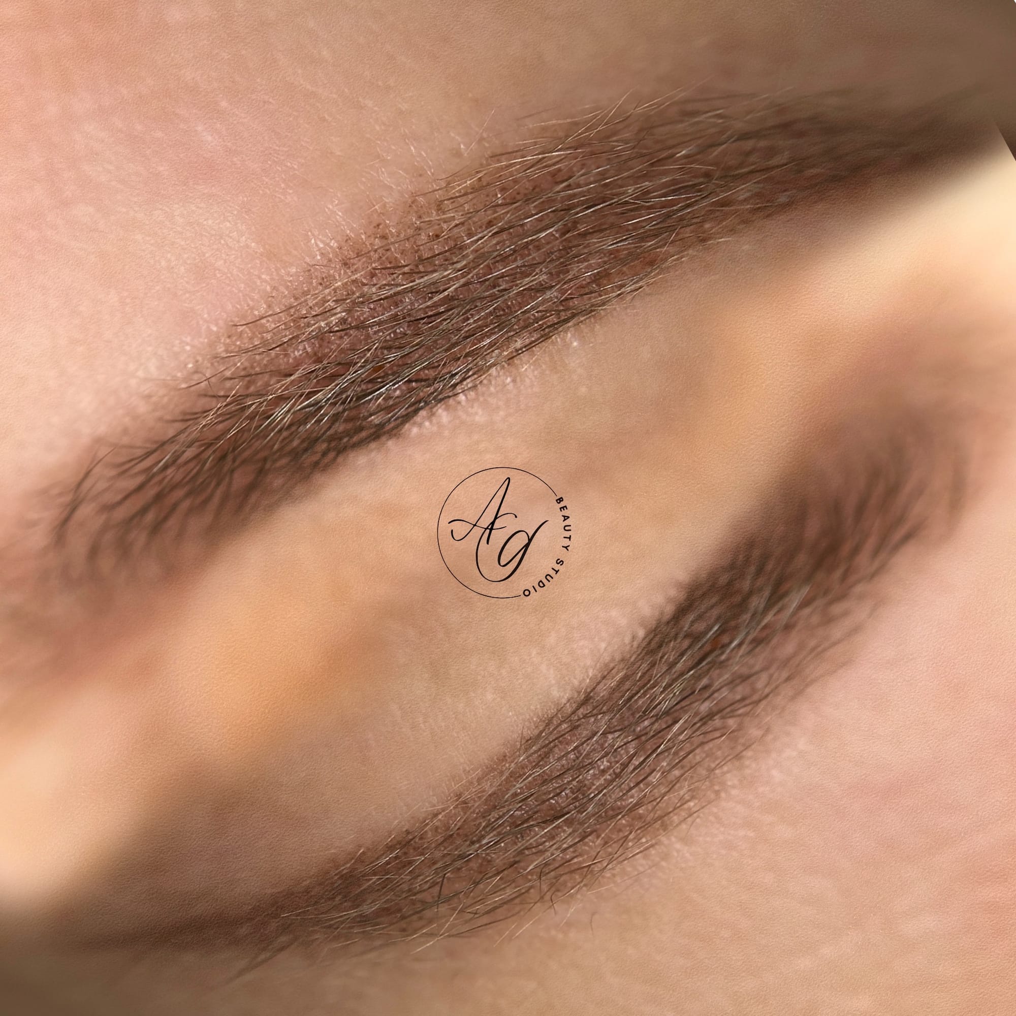 Rezultat vindecat pe ten matur