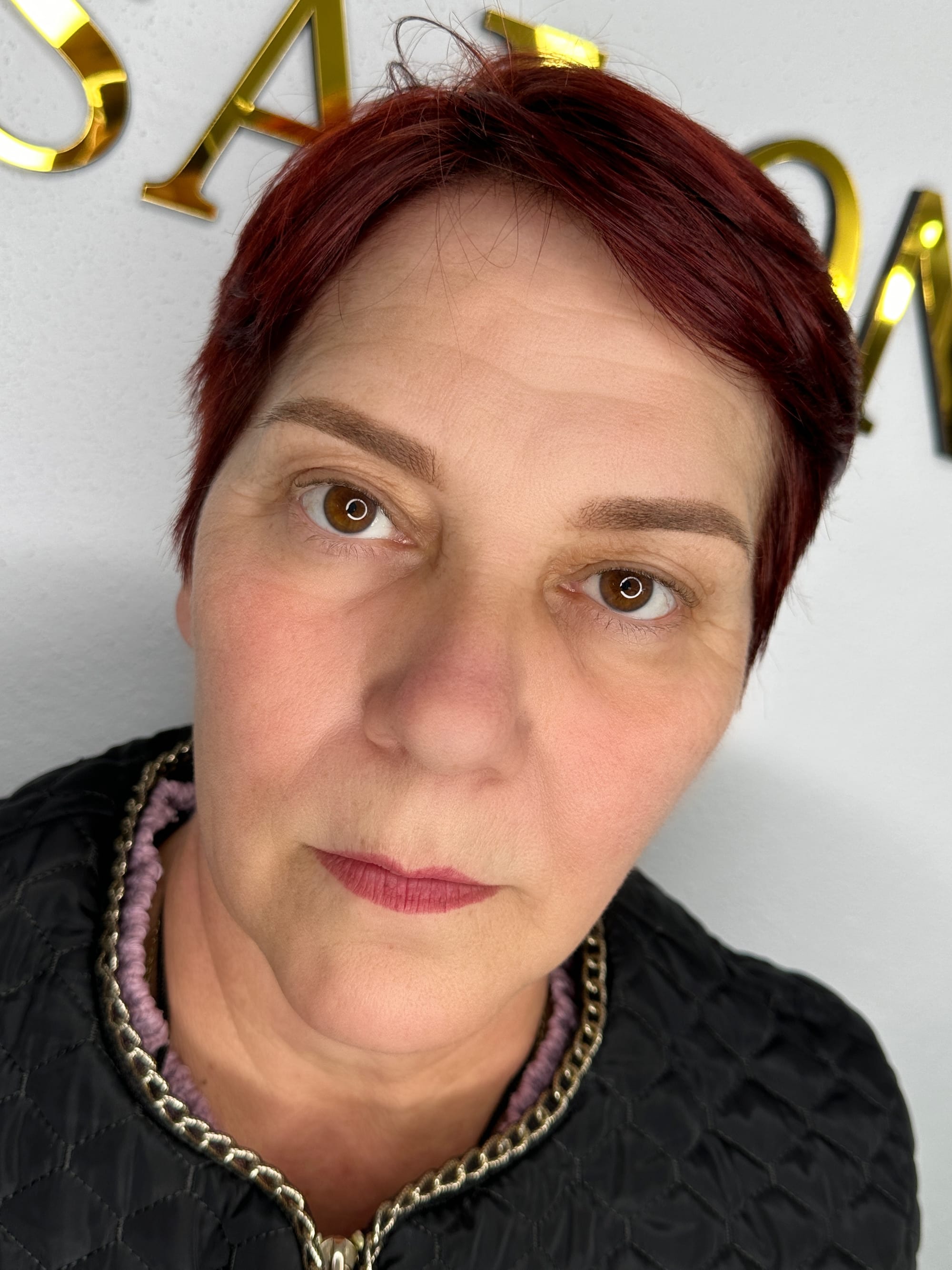 Rezultat vindecat pe ten matur