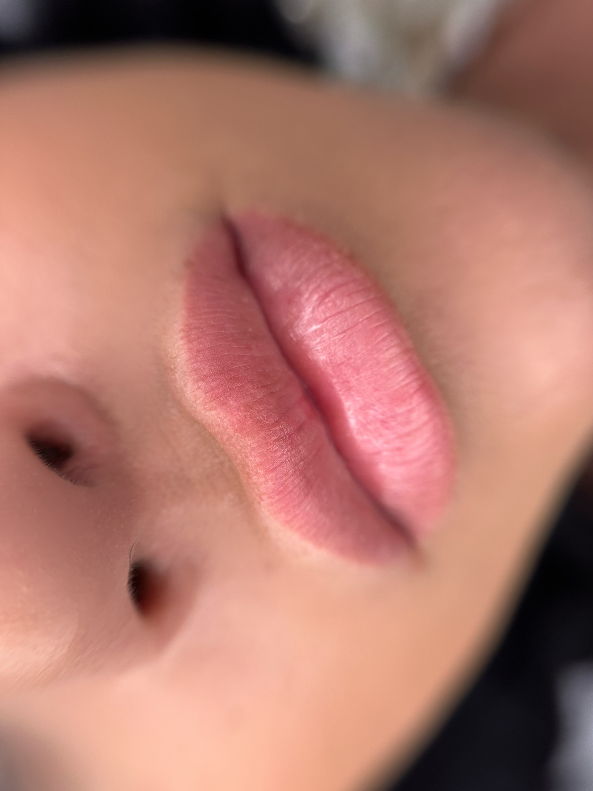 Vindecat | Raspberry lips