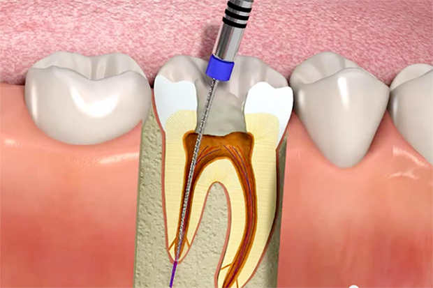 Conservativa &amp; Endodonzia