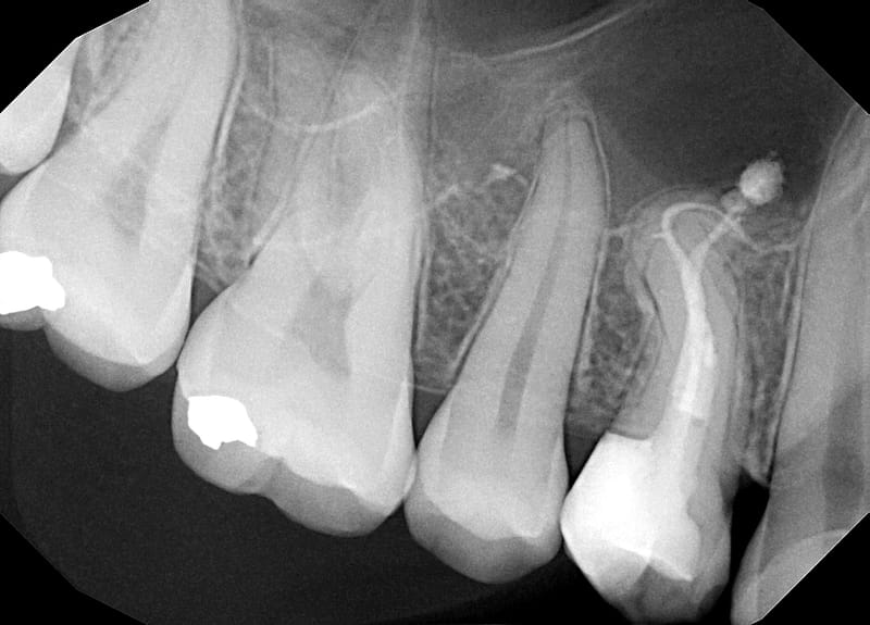 Leczenie pierwotne d.24