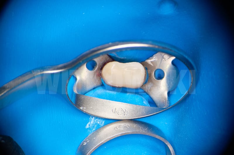 Leczenie powtórne d.24