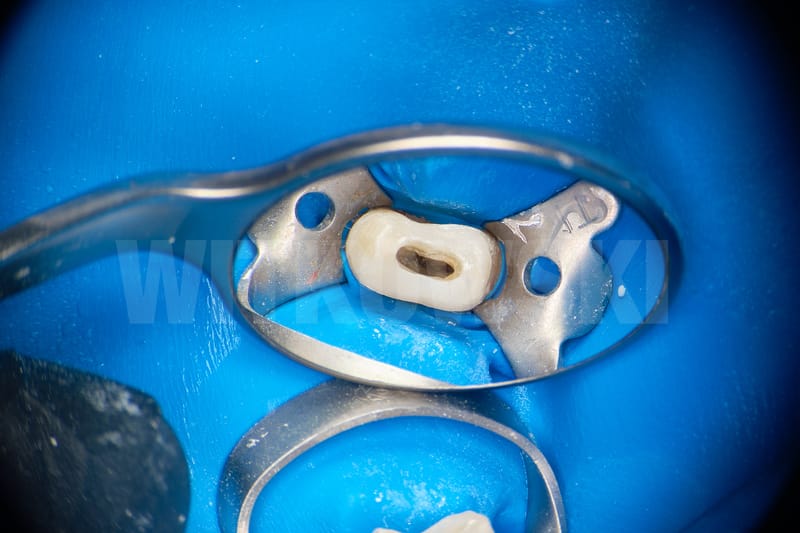 Leczenie powtórne d.24