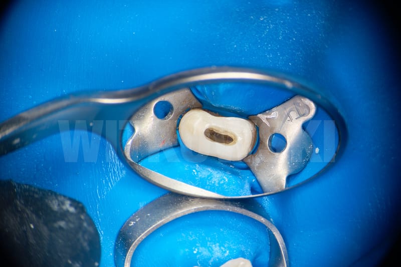 Leczenie powtórne d.24