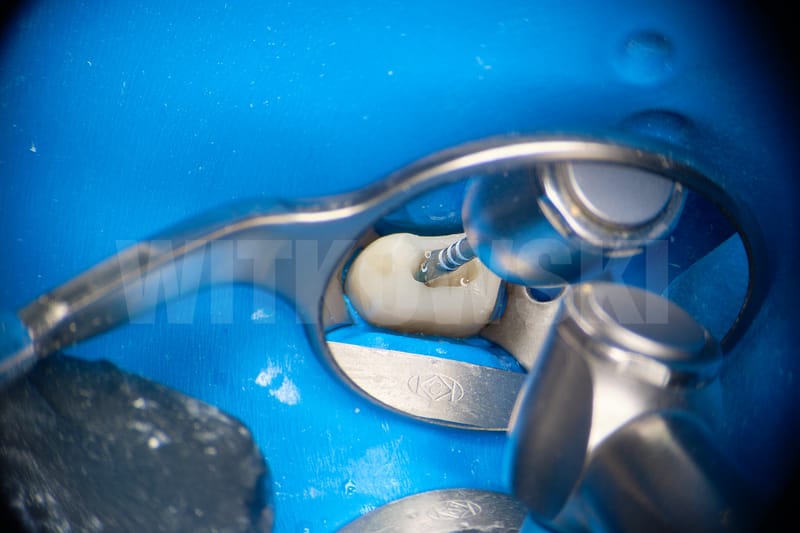 Leczenie powtórne d.24