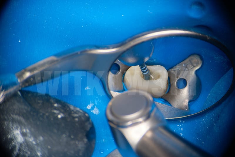 Leczenie powtórne d.24