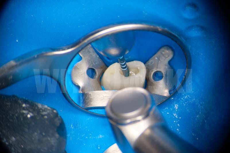 Leczenie powtórne d.24