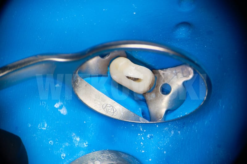 Leczenie powtórne d.24