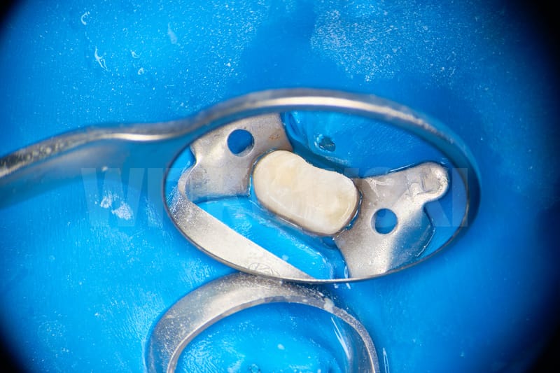 Leczenie powtórne d.24