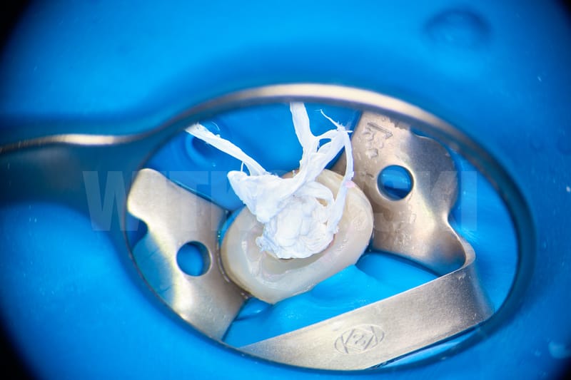 Leczenie pierwotne d.24