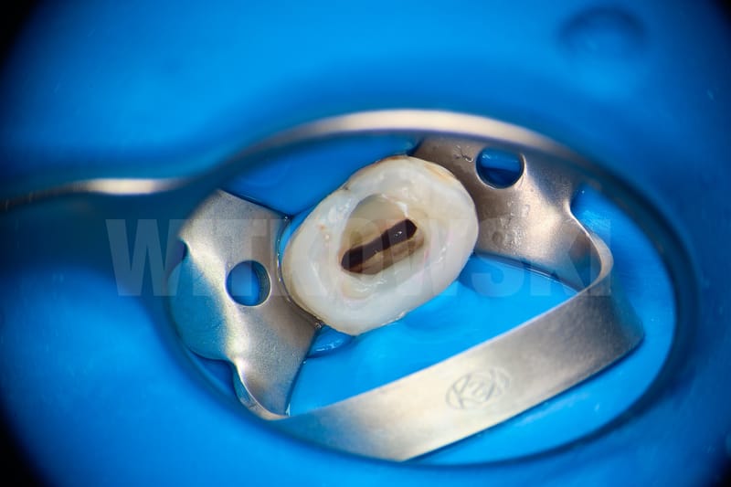 Leczenie pierwotne d.24