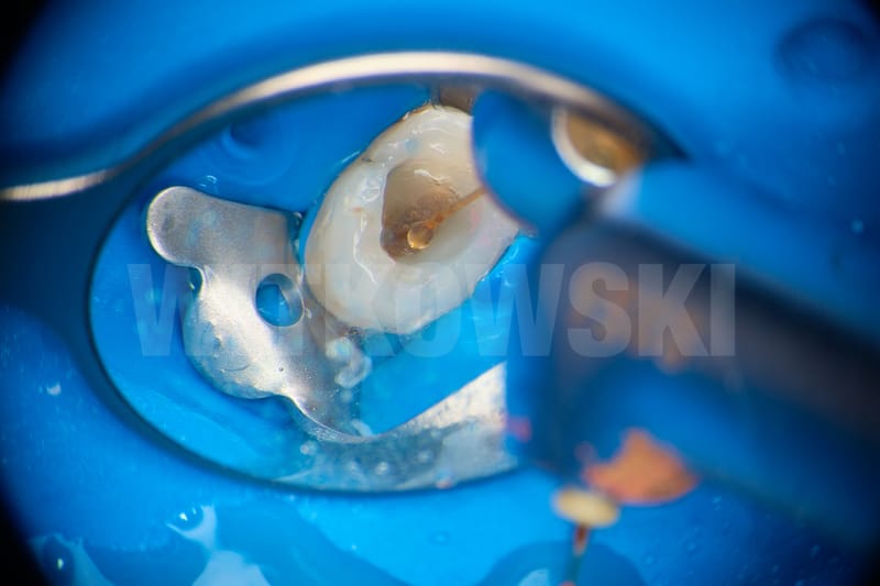 Leczenie pierwotne d.24