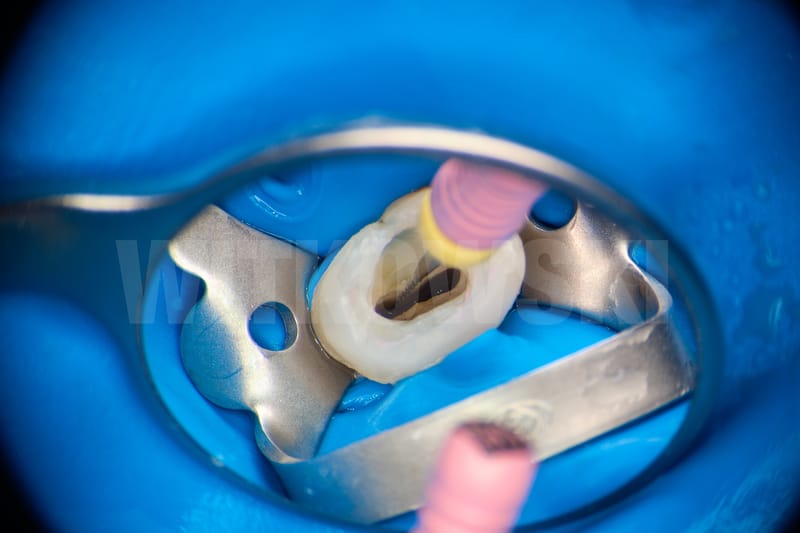 Leczenie pierwotne d.24