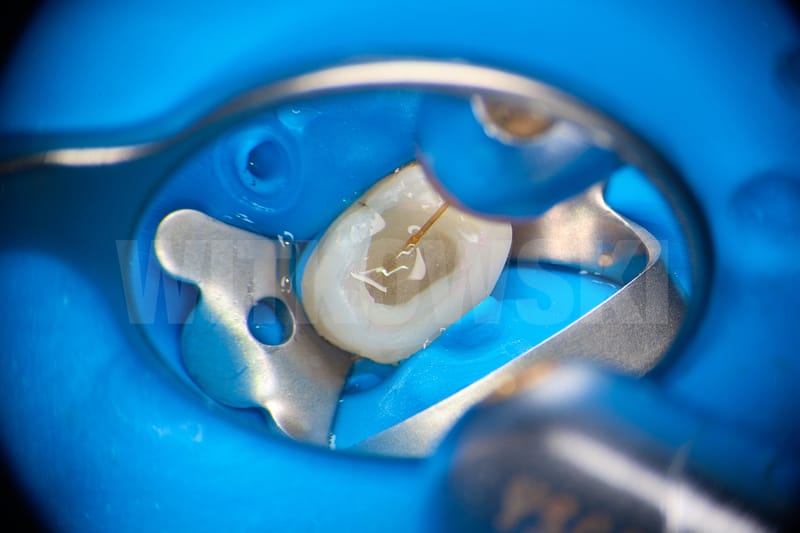 Leczenie pierwotne d.24