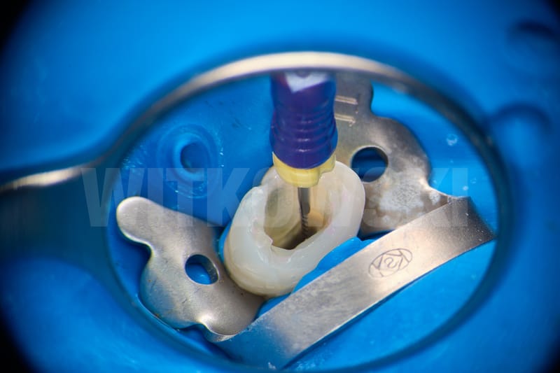 Leczenie pierwotne d.24