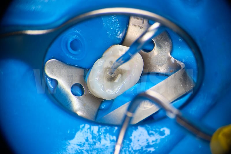 Leczenie pierwotne d.24