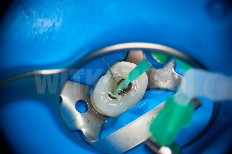 Leczenie pierwotne d.24