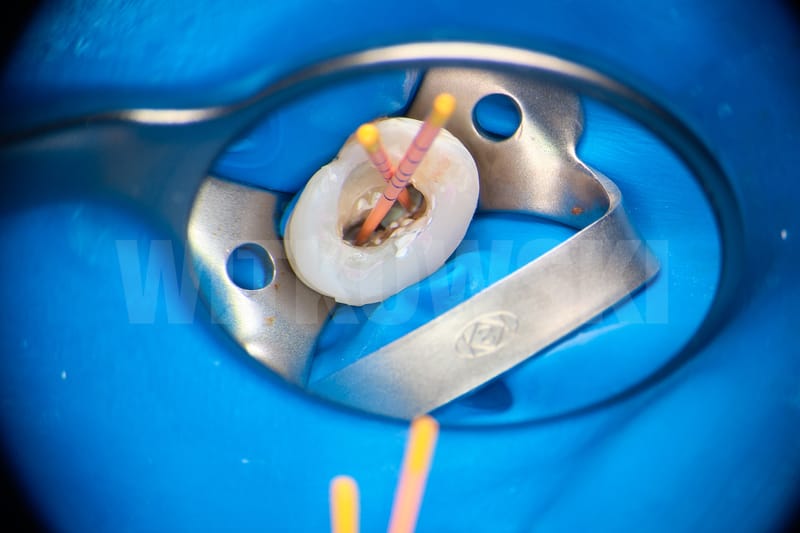 Leczenie pierwotne d.24