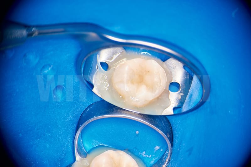 Leczenie pierwotne d.18