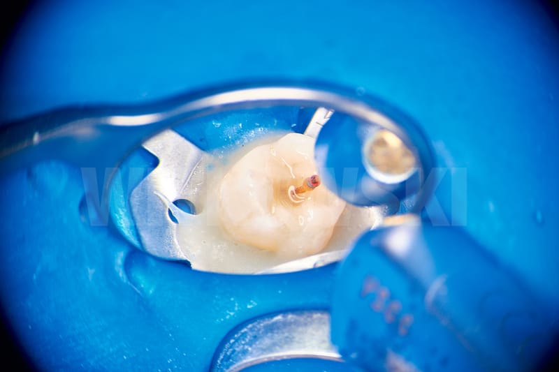 Leczenie pierwotne d.18