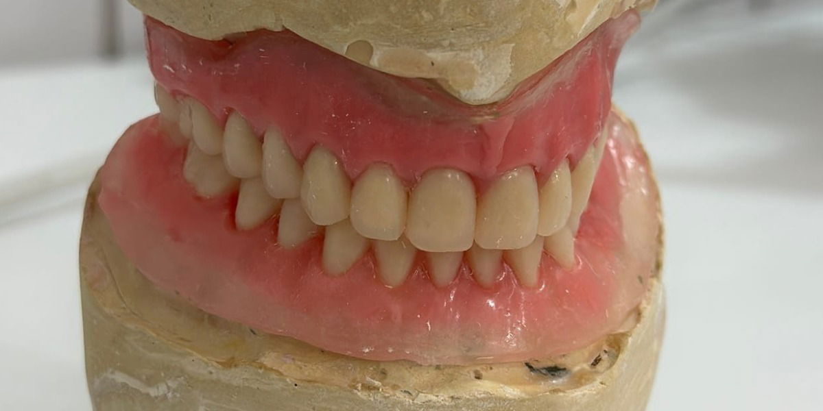 Prótese dentária