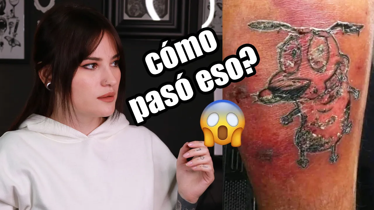 Infecciones en los Tatuajes: Cómo Reconocer y Curar un Tatuaje Infectado