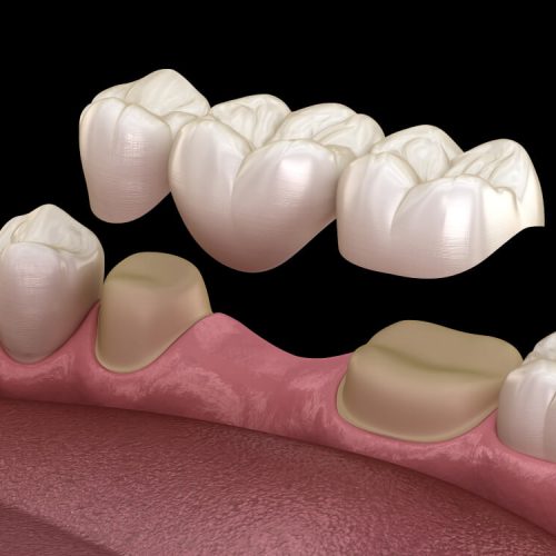 REHABILITACIÓN ORAL