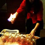 Chinese Glass Cupping