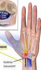 Chinese Nerve Art Massage