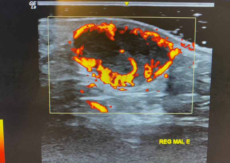 Ultrassom Dermatológico