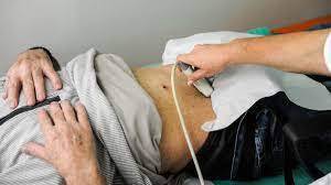 ULTRASSOM DE PRÓSTATA 