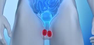 ULTRASSOM DE BOLSA ESCROTAL COM DOPPLER