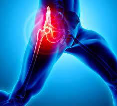 ULTRASSOM DE QUADRIL