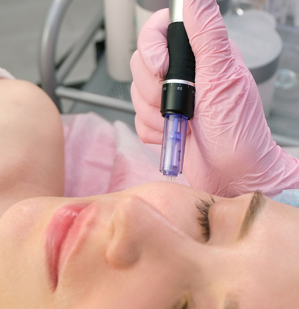 Indução percutânea de ativos