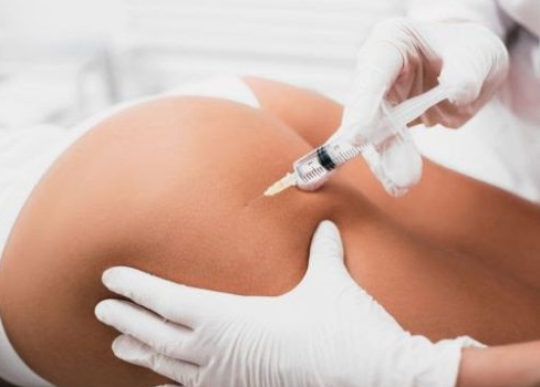 Intradermoterapia Corporal