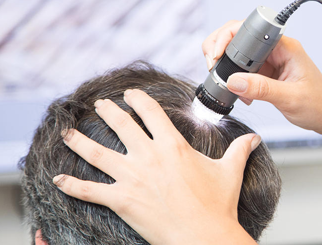 Avaliação com Tricoscópio