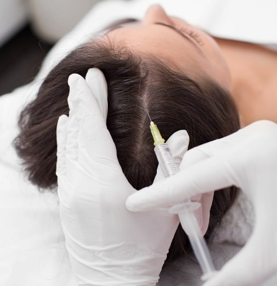 Intradermoterapia Capilar