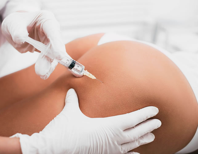 Harmonização nos glúteos