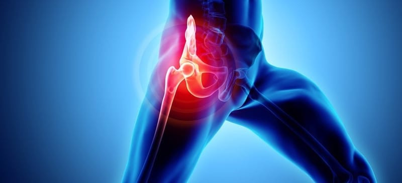 What Are the Advantages of Choosing the Best Hip Replacement Surgeon in Delhi?