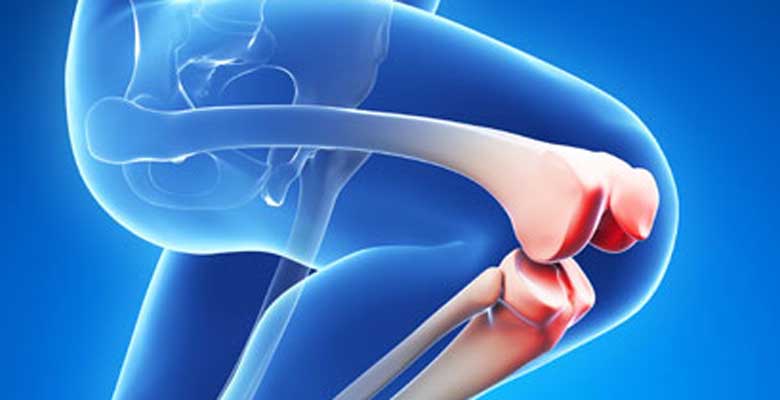 Dos and Don’ts for Knee Replacement Surgery – What You Need to Know?