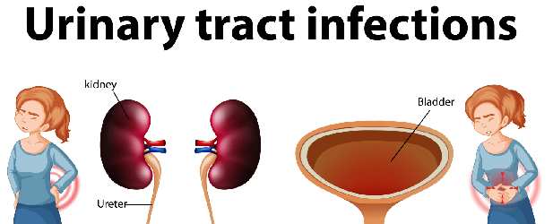 Navigating Urinary Tract Infections: Expert Care