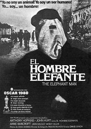 EL HOMBRE ELEFANTE: Gracias John
