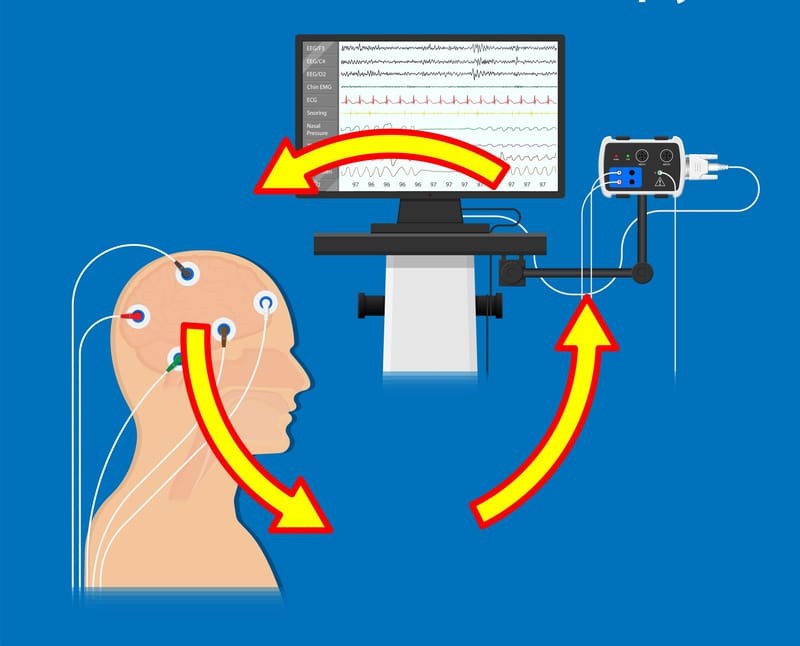 Neurofeedback loop
