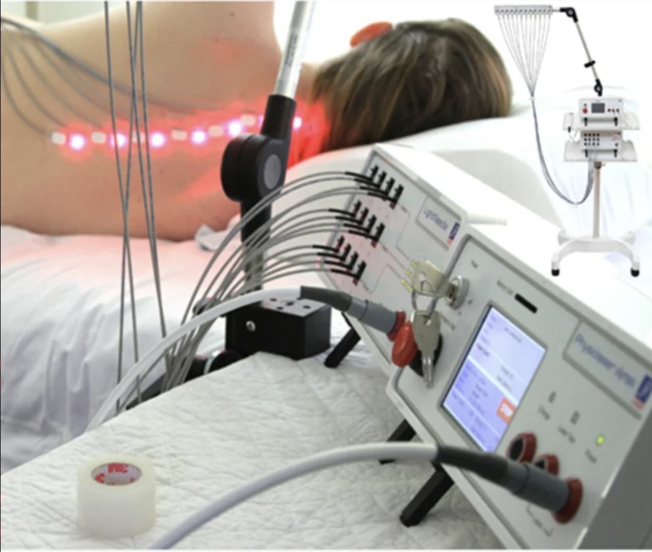 Myotherapy with Laser