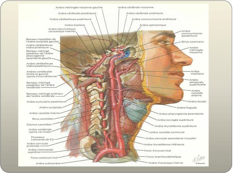 EchoDoppler des troncs supra-aortiques