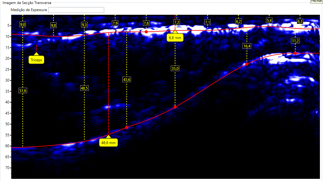 Escaneamento de Tríceps
